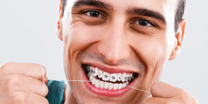 How To Floss With Braces